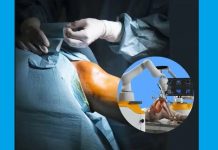 हड्डियों के इलाज में Robotic क्रांति: Technology तैयार है, लेकिन क्या आपका Insurance साथ देगा? भारत में सर्जरी गैप के बीच रोबोटिक जॉइंट रिप्लेसमेंट के लिए बराबरी वाले इंश्योरेंस कवर की मांग तेज: PFCD