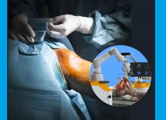 हड्डियों के इलाज में Robotic क्रांति: Technology तैयार है, लेकिन क्या आपका Insurance साथ देगा? भारत में सर्जरी गैप के बीच रोबोटिक जॉइंट रिप्लेसमेंट के लिए बराबरी वाले इंश्योरेंस कवर की मांग तेज: PFCD